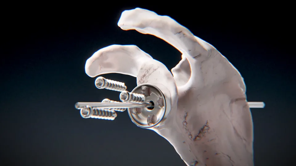 Titanium Strut - image 1